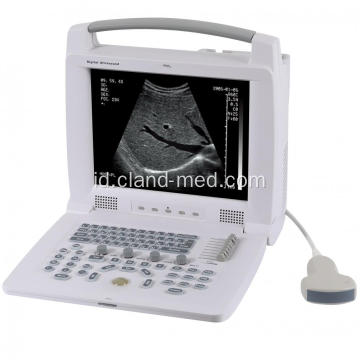 Laptop Portable Ultrasound Scanner Harga Mesin Ultrasound